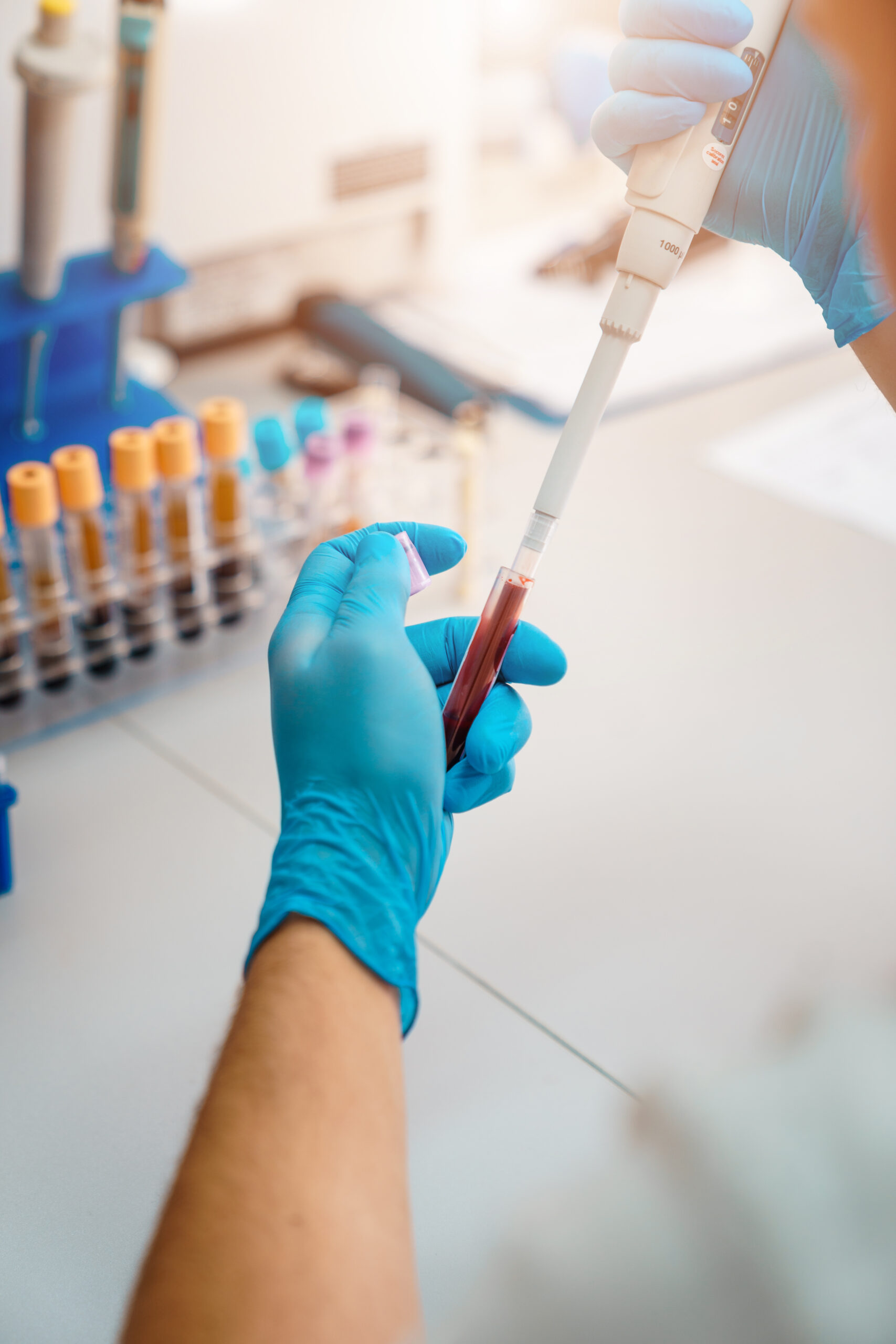 Escreen Lab Streamlining Employee Drug Screening with ExpressMD Urgent Care and ...